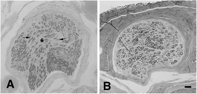 The Peripheral Nervous System in Amyotrophic Lateral Sclerosis: Opportunities for Translational Research